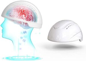 transcranial photobiomodulation neuronic